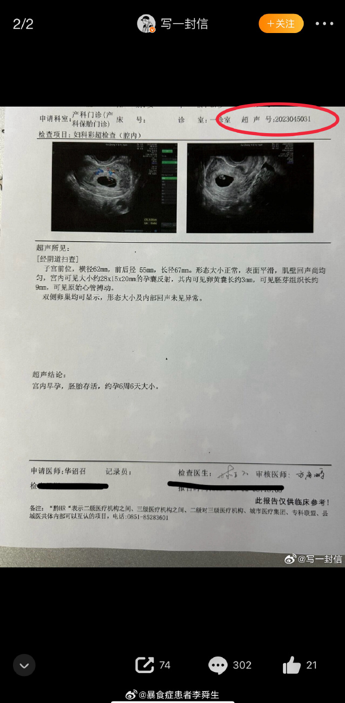 今日沙雕：建议美国把26个字母改成25个字母，因为n是反u的187